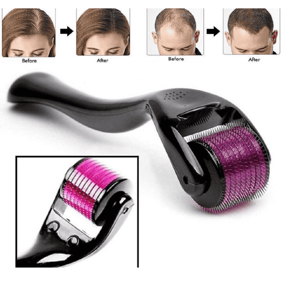 Comparative images showing skin condition before and after using the derma roller