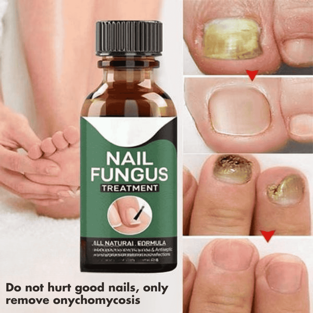 Key benefits of Foot Cure Nail Repair Serum