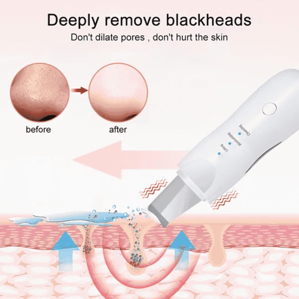 Illustration of a blackhead removal tool with before and after effects on skin.