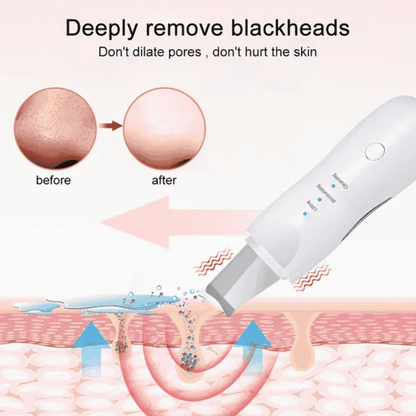 Illustration of a blackhead removal tool with before and after effects on skin.