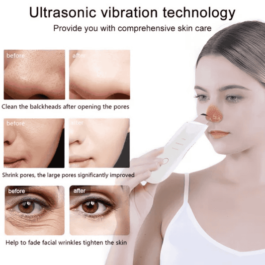 Woman using a device with text about ultrasonic vibration technology for skin care.